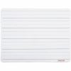 Universal Dry Erase Board 1